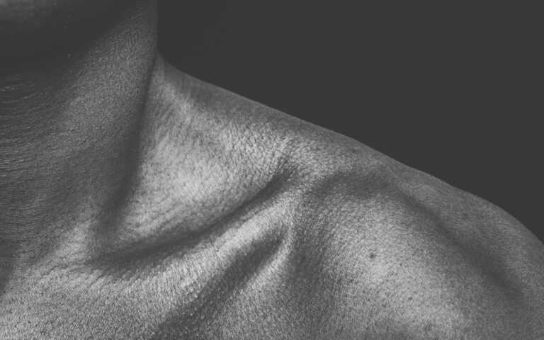 أعراض عضلية هيكلية بعد جراحة تعديل النوع الاجتماعي: دراسة استقصائية مهمة